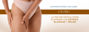 eliminar estrías blancas y rojas con láser en Madrid.